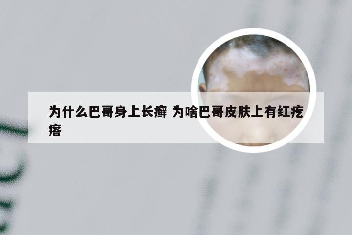 为什么巴哥身上长癣 为啥巴哥皮肤上有红疙瘩