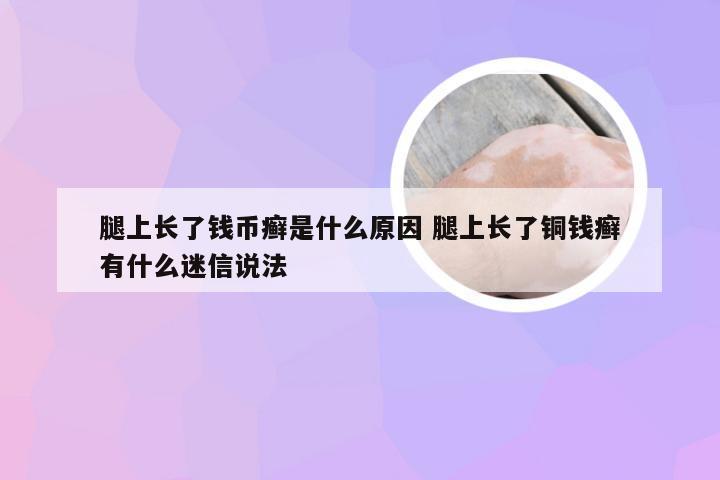 腿上长了钱币癣是什么原因 腿上长了铜钱癣有什么迷信说法