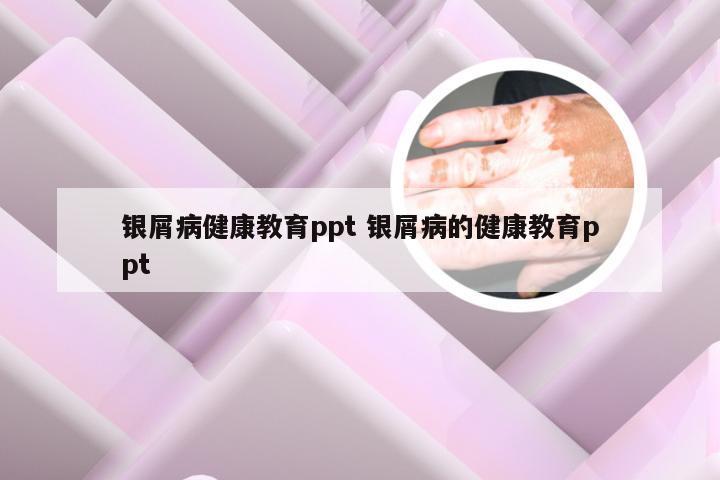 银屑病健康教育ppt 银屑病的健康教育ppt