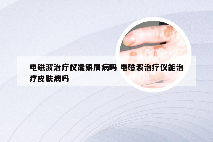 电磁波治疗仪能银屑病吗 电磁波治疗仪能治疗皮肤病吗