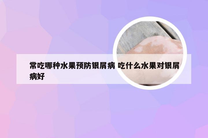 常吃哪种水果预防银屑病 吃什么水果对银屑病好