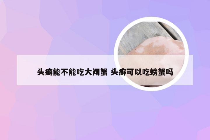 头癣能不能吃大闸蟹 头癣可以吃螃蟹吗