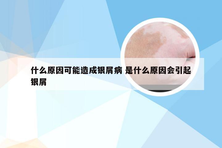 什么原因可能造成银屑病 是什么原因会引起银屑