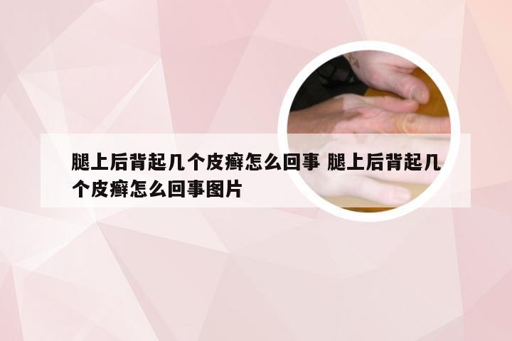 腿上后背起几个皮癣怎么回事 腿上后背起几个皮癣怎么回事图片