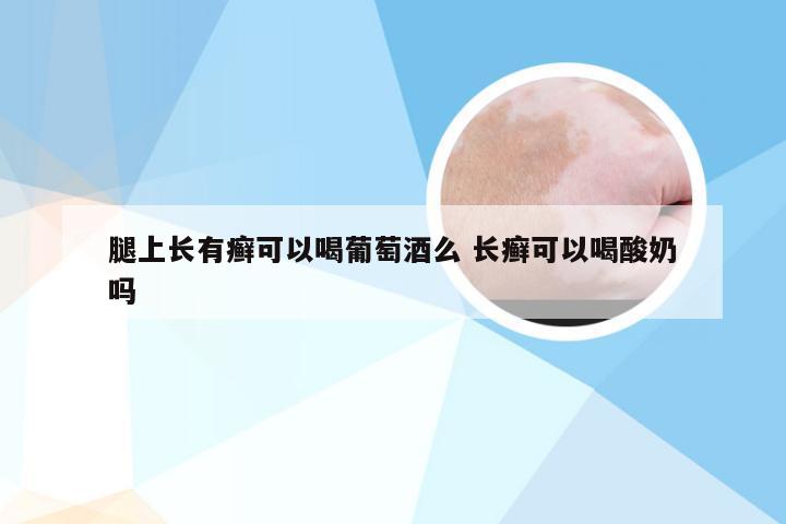 腿上长有癣可以喝葡萄酒么 长癣可以喝酸奶吗