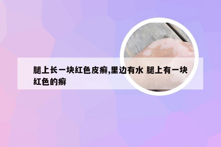 腿上长一块红色皮癣,里边有水 腿上有一块红色的癣