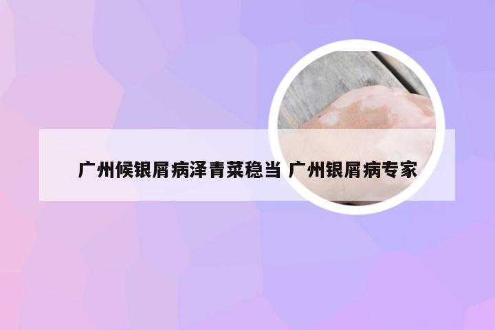 广州候银屑病泽青菜稳当 广州银屑病专家