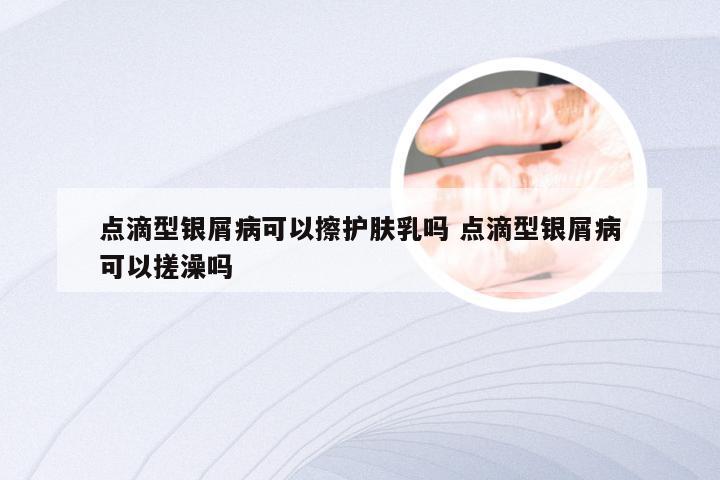 点滴型银屑病可以擦护肤乳吗 点滴型银屑病可以搓澡吗