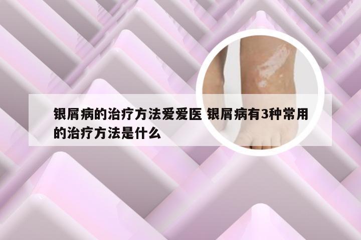 银屑病的治疗方法爱爱医 银屑病有3种常用的治疗方法是什么