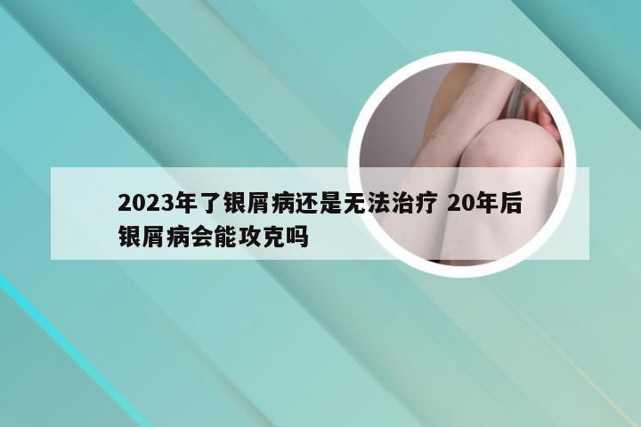 2023年了银屑病还是无法治疗 20年后银屑病会能攻克吗