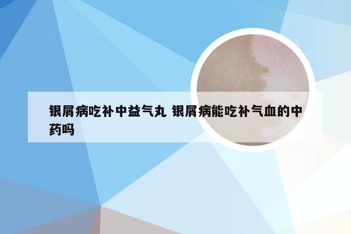 银屑病吃补中益气丸 银屑病能吃补气血的中药吗