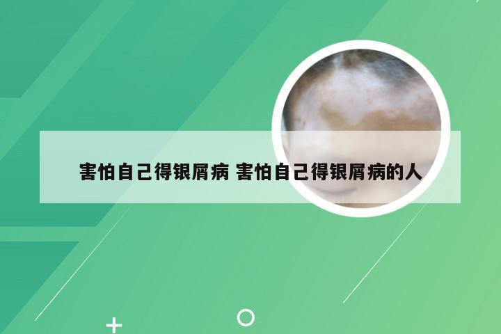 害怕自己得银屑病 害怕自己得银屑病的人