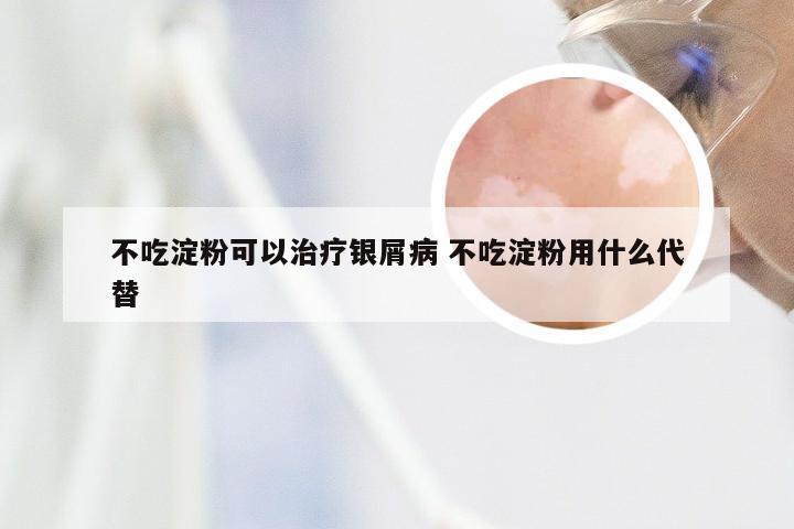 不吃淀粉可以治疗银屑病 不吃淀粉用什么代替