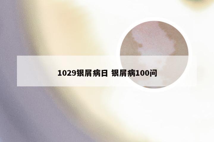 1029银屑病日 银屑病100问