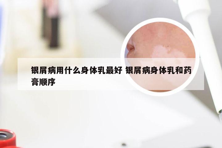 银屑病用什么身体乳最好 银屑病身体乳和药膏顺序