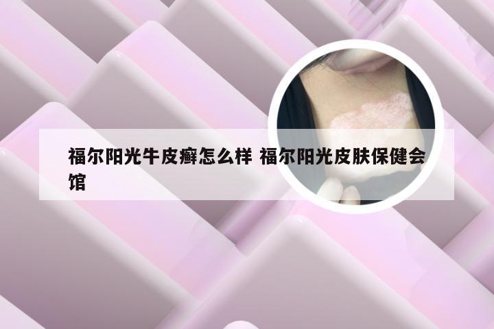 福尔阳光牛皮癣怎么样 福尔阳光皮肤保健会馆