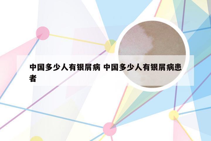 中国多少人有银屑病 中国多少人有银屑病患者