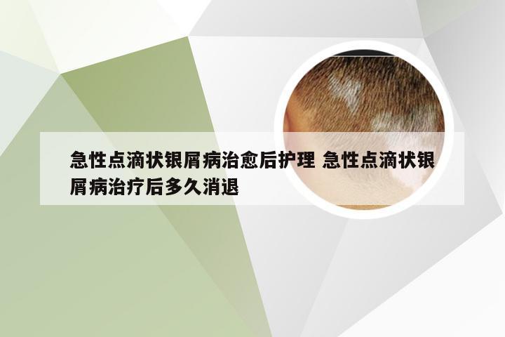 急性点滴状银屑病治愈后护理 急性点滴状银屑病治疗后多久消退