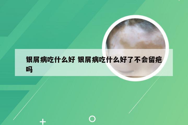 银屑病吃什么好 银屑病吃什么好了不会留疤吗