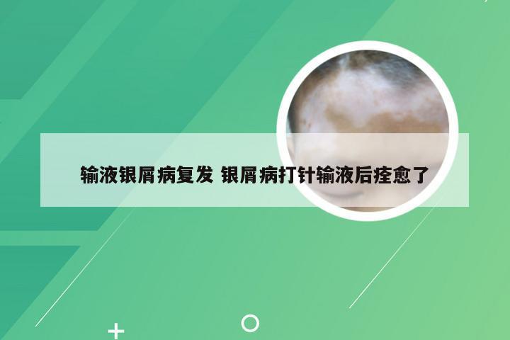 输液银屑病复发 银屑病打针输液后痊愈了