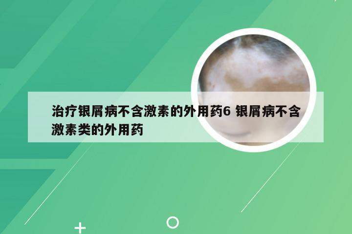 治疗银屑病不含激素的外用药6 银屑病不含激素类的外用药