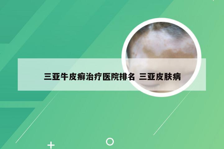 三亚牛皮癣治疗医院排名 三亚皮肤病