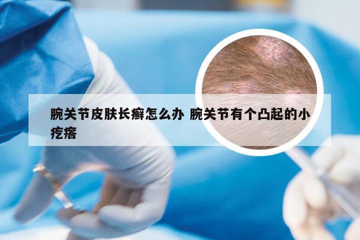 腕关节皮肤长癣怎么办 腕关节有个凸起的小疙瘩