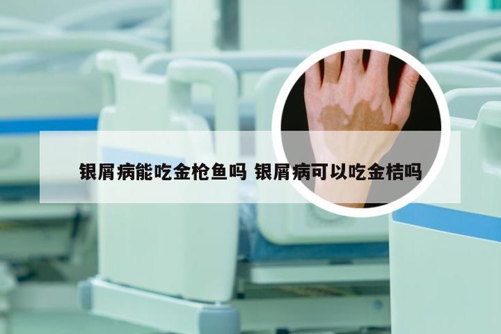 银屑病能吃金枪鱼吗 银屑病可以吃金桔吗