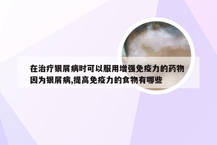 在治疗银屑病时可以服用增强免疫力的药物 因为银屑病,提高免疫力的食物有哪些