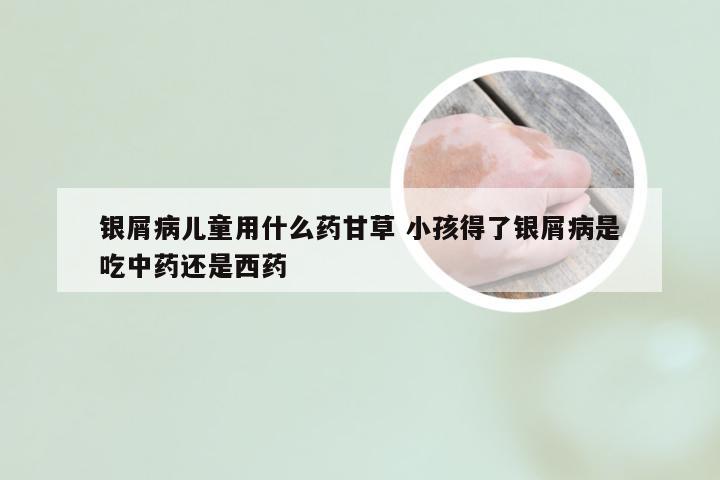 银屑病儿童用什么药甘草 小孩得了银屑病是吃中药还是西药