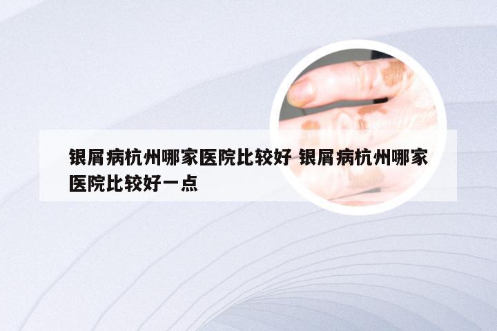 银屑病杭州哪家医院比较好 银屑病杭州哪家医院比较好一点