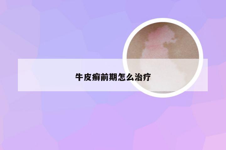 牛皮癣前期怎么治疗