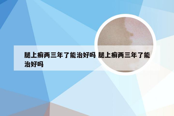 腿上癣两三年了能治好吗 腿上癣两三年了能治好吗