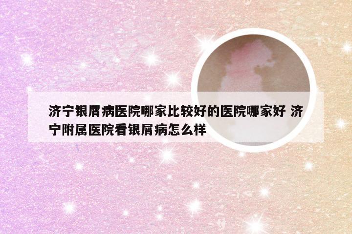 济宁银屑病医院哪家比较好的医院哪家好 济宁附属医院看银屑病怎么样