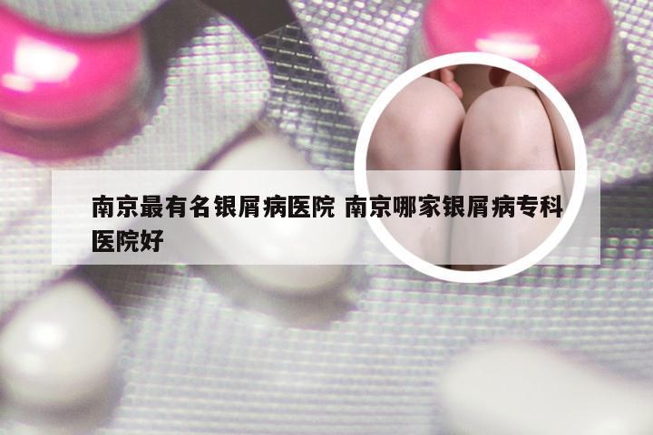 南京最有名银屑病医院 南京哪家银屑病专科医院好