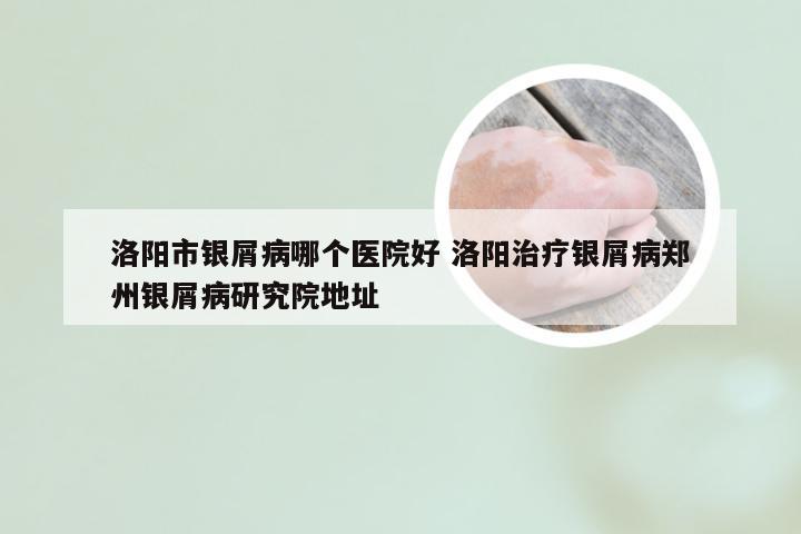 洛阳市银屑病哪个医院好 洛阳治疗银屑病郑州银屑病研究院地址