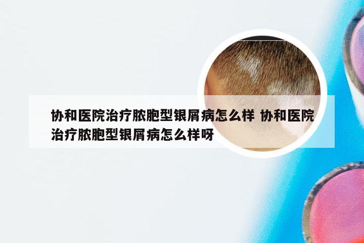 协和医院治疗脓胞型银屑病怎么样 协和医院治疗脓胞型银屑病怎么样呀