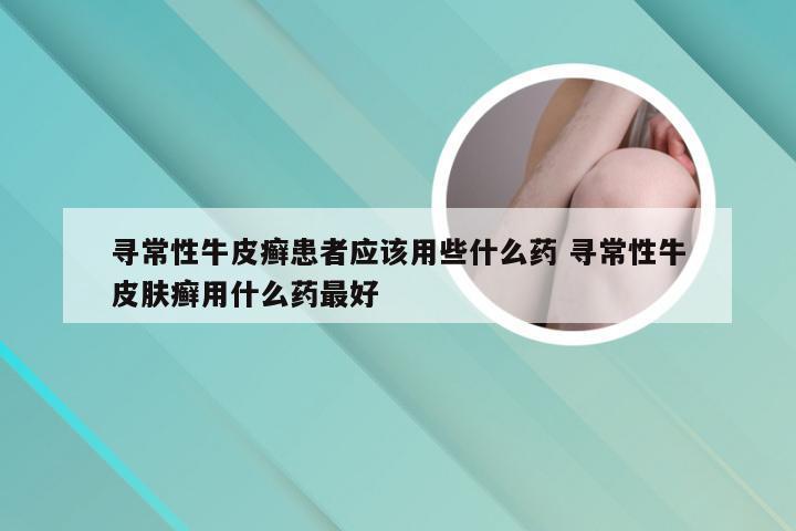 寻常性牛皮癣患者应该用些什么药 寻常性牛皮肤癣用什么药最好