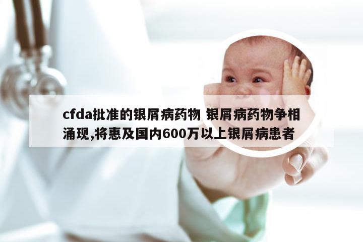 cfda批准的银屑病药物 银屑病药物争相涌现,将惠及国内600万以上银屑病患者