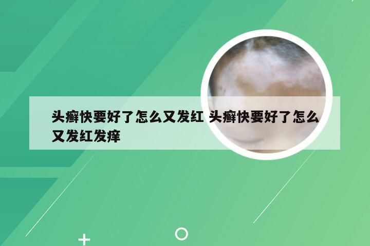 头癣快要好了怎么又发红 头癣快要好了怎么又发红发痒