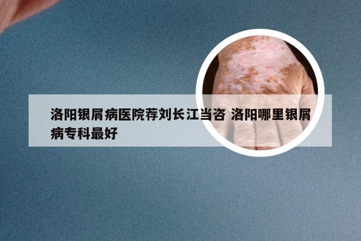 洛阳银屑病医院荐刘长江当咨 洛阳哪里银屑病专科最好