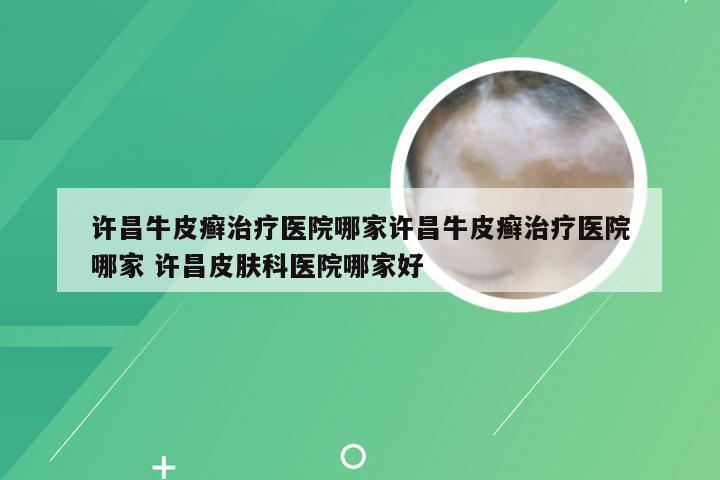 许昌牛皮癣治疗医院哪家许昌牛皮癣治疗医院哪家 许昌皮肤科医院哪家好