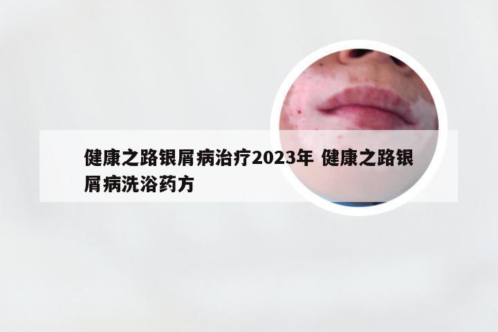 健康之路银屑病治疗2023年 健康之路银屑病洗浴药方