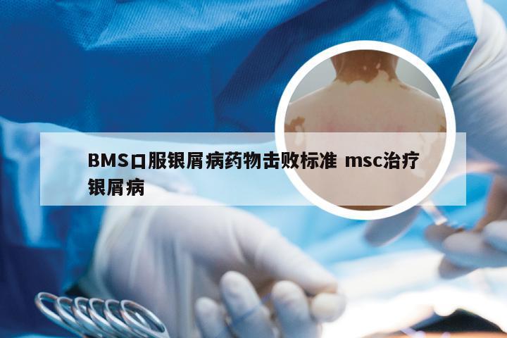 BMS口服银屑病药物击败标准 msc治疗银屑病