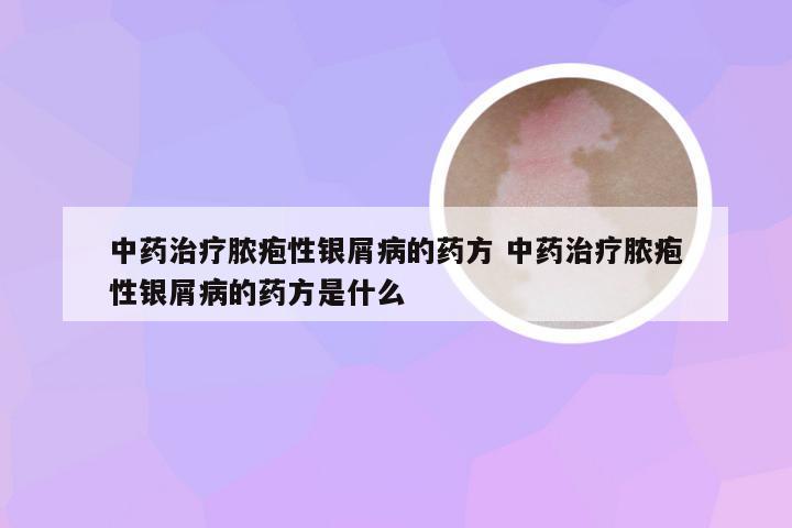 中药治疗脓疱性银屑病的药方 中药治疗脓疱性银屑病的药方是什么