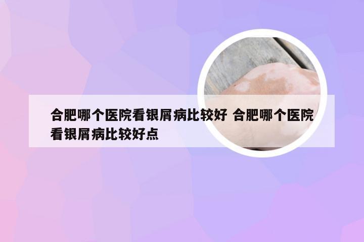 合肥哪个医院看银屑病比较好 合肥哪个医院看银屑病比较好点