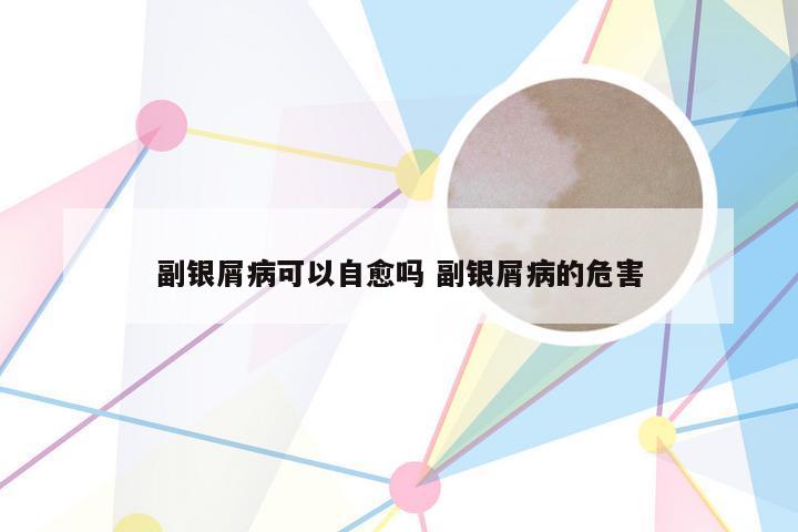 副银屑病可以自愈吗 副银屑病的危害