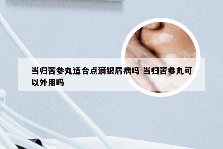 当归苦参丸适合点滴银屑病吗 当归苦参丸可以外用吗