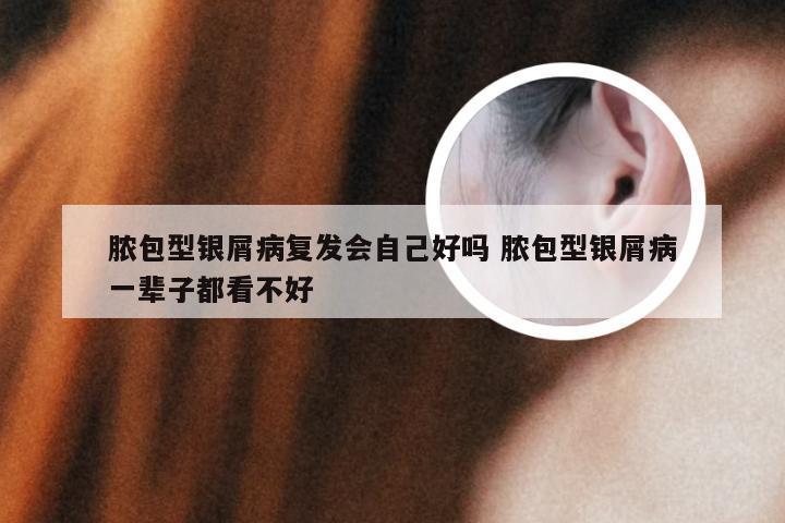 脓包型银屑病复发会自己好吗 脓包型银屑病一辈子都看不好