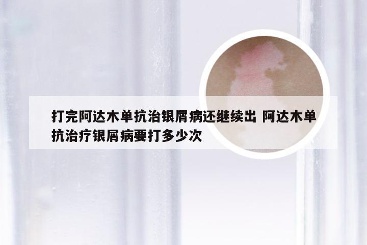 打完阿达木单抗治银屑病还继续出 阿达木单抗治疗银屑病要打多少次